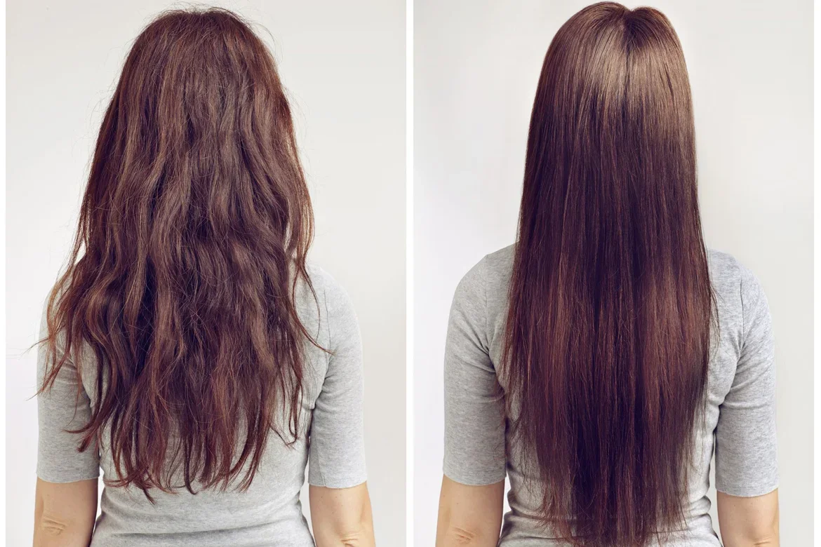 Hair Replacement