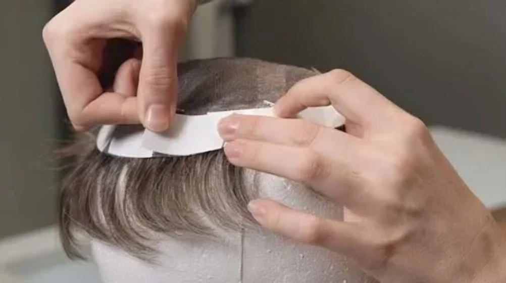 Full Tape-Based Hair Patch Service in Hyderabad at B The Best Hair Studio